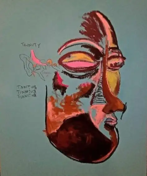 Tinnitus Ear Nose Throat, John Lister-min